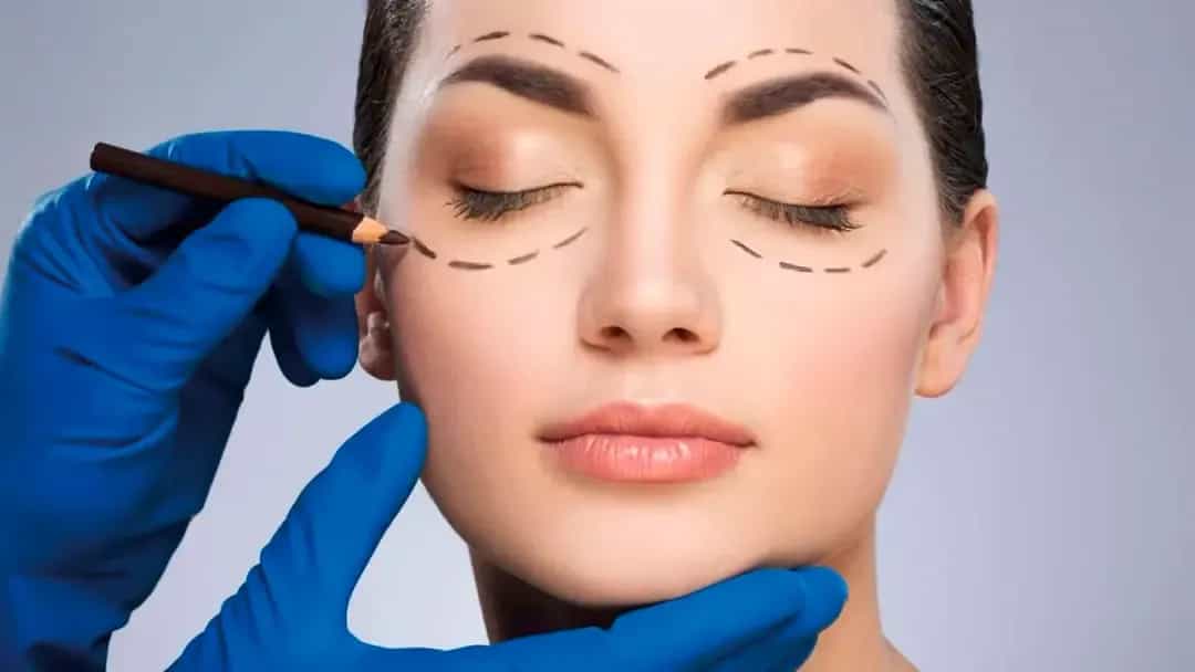 Blefaroplastika