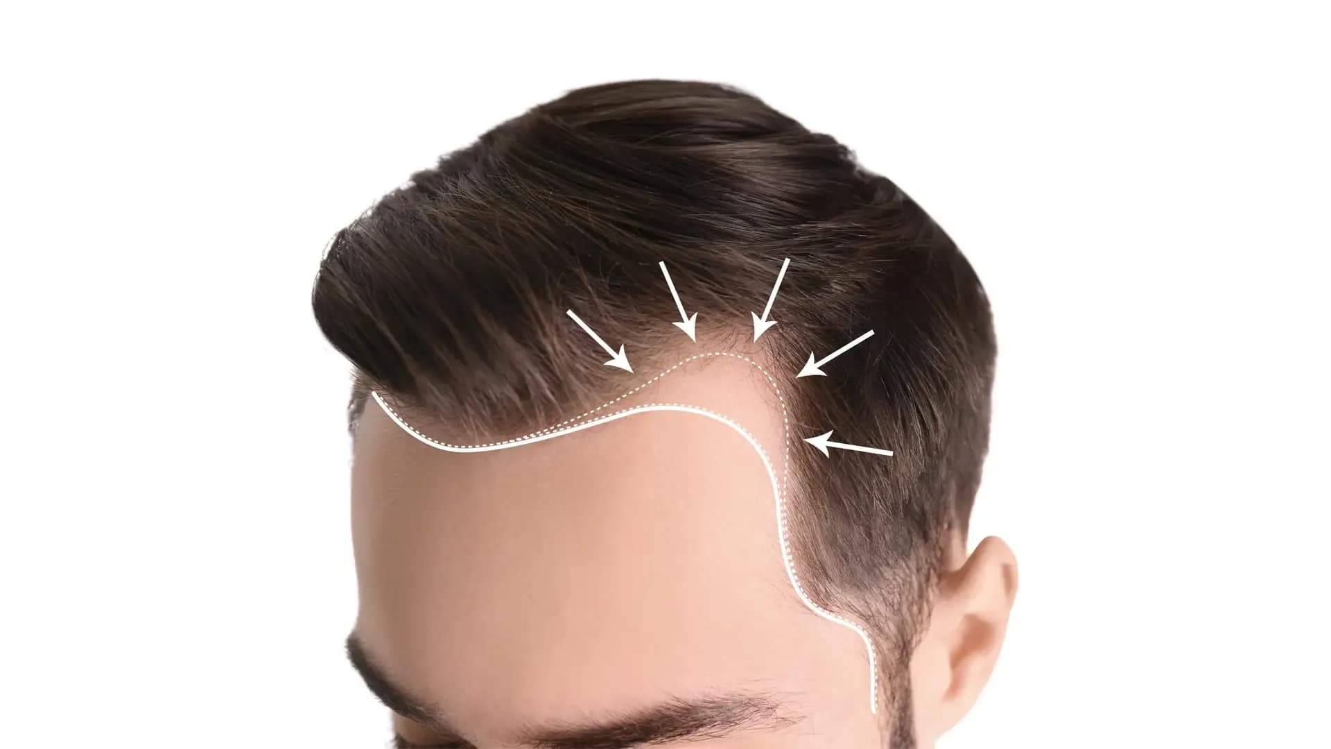Trixologiya