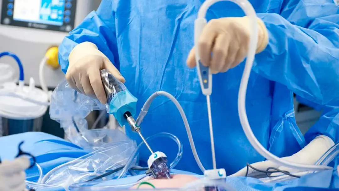 Tuxumdon kistasini davolashning kelajagi: Bizning klinikamiz ilg'or texnologiyalar bo'yicha yetakchi hisoblanadi