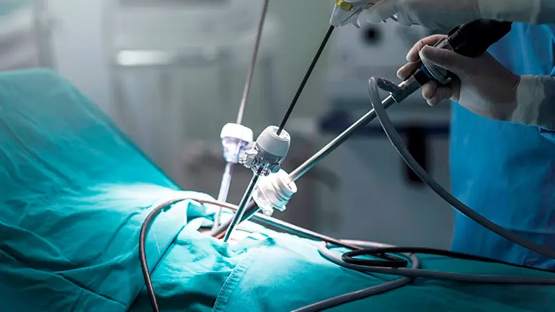 Holesistitni davolash haqida nima bilish kerak?