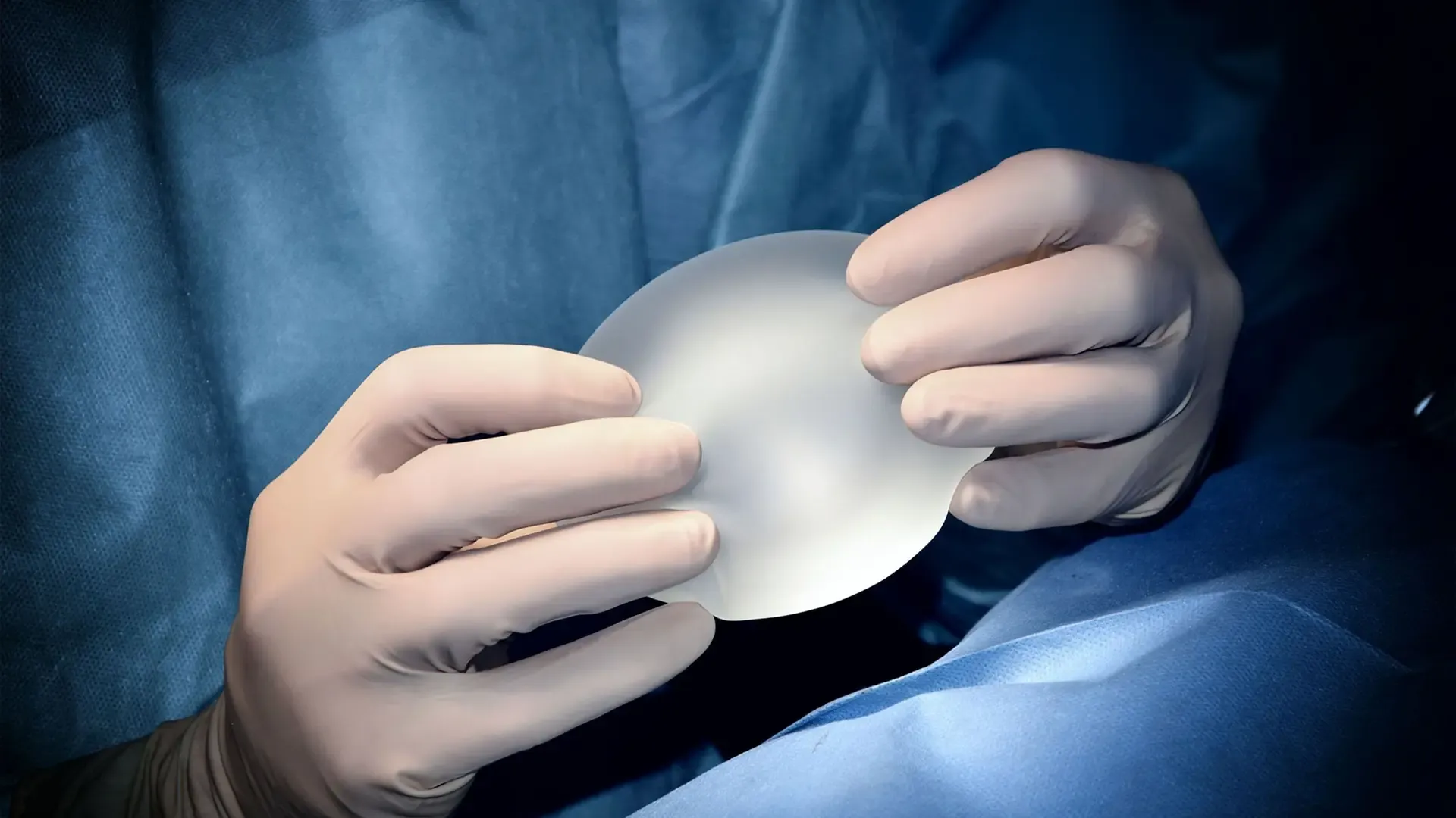 Ko'krakni kichraytirish plastikasi